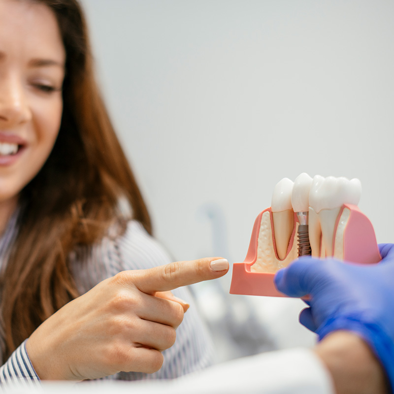 Dentist showing dental implants to patients